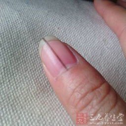 手指甲起层的图片 指甲结构图片 正常指甲 指甲疾病图解 拇指指甲图片