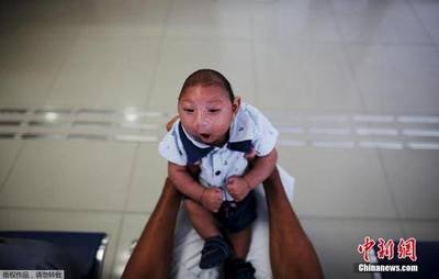 中国奇形婴儿 360图片