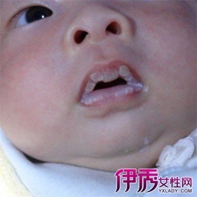 下嘴唇里面起泡 360图片