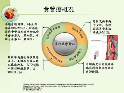 食管癌