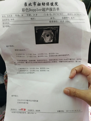 请问上环会怀孕吗