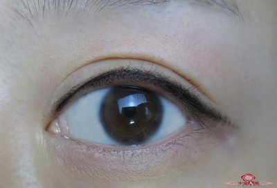 三点双眼皮多久能化妆