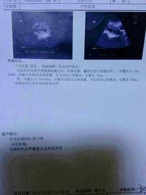 怀孕初期一到晚上就想吐