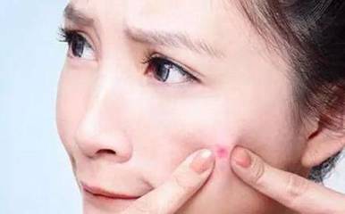 长期长痘痘怎么调理