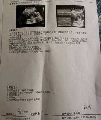 白带淡粉色是怎么回事