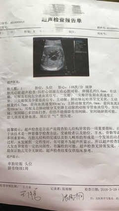 胎儿心脏检查