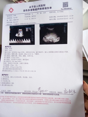 怀孕四个月宝宝多大