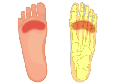 脚掌骨头疼是怎么回事