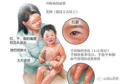 五岁宝宝肚子疼