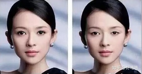 割了双眼皮后特后悔