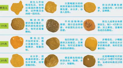宝宝便便颜色