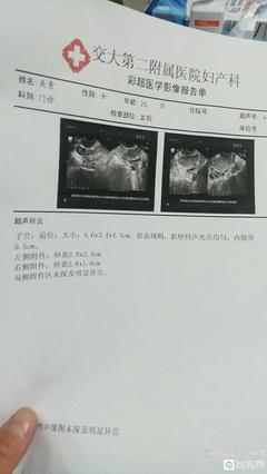 输卵管有积液是怎么回事