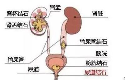 肾的两边疼是怎么回事