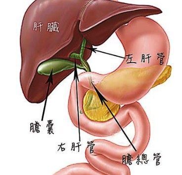 肝管瘤怎么治疗方法