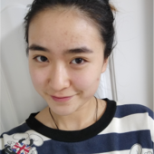 额头大又不想留刘海