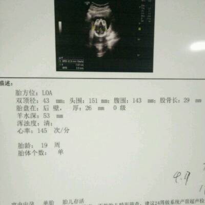 四个月宝宝头围标准