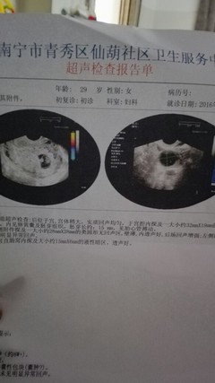 怀孕了怎么看男女