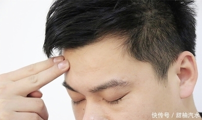 额头总出汗是怎么回事