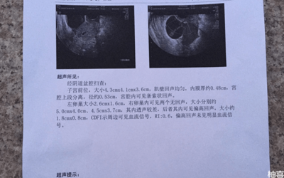 体检会查出怀孕吗