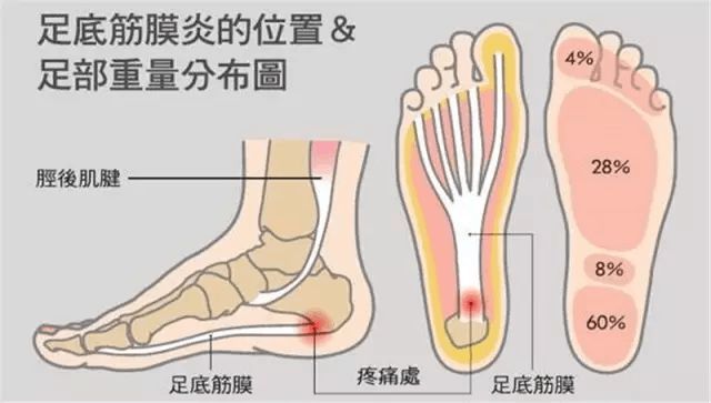 足底疼是怎么回事