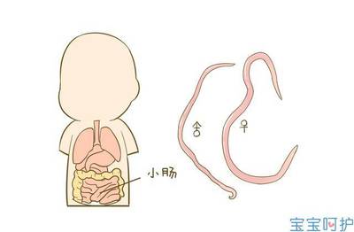 如何判断肚子里有蛔虫