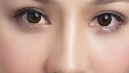 做双眼皮老了会怎样