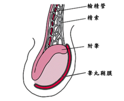 睾丸积液怎么治疗