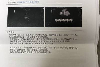 孕妇胎儿心跳多少正常