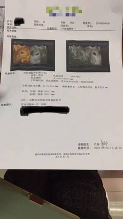 怀孕着床晚是什么意思