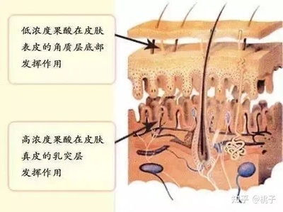 长闭口痘痘的地方变黑