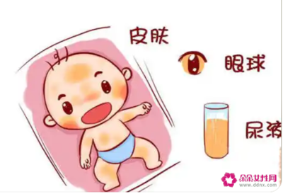 母乳停多少小时黄疸能好