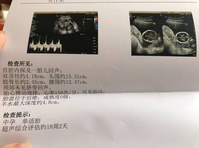 怀孕18周胎儿稳定了吗