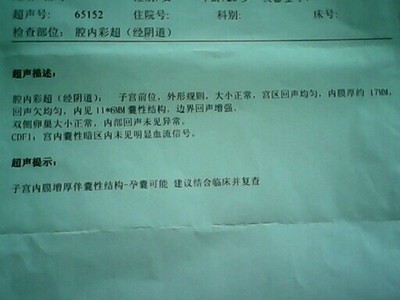 怀孕40天能看出男女吗