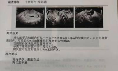 怀孕多久可见孕囊