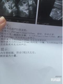 怀孕7周有胎心胎芽吗