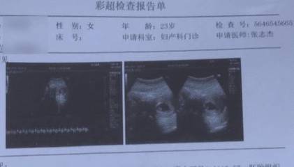 全麻之后多久可以怀孕