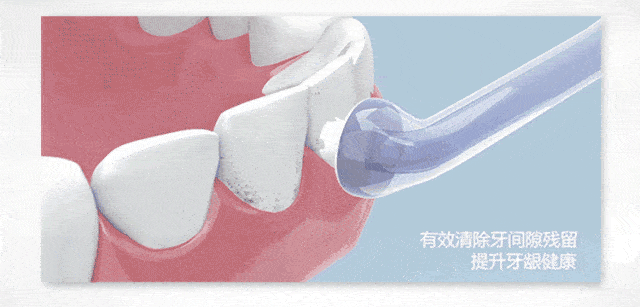 口腔小分享