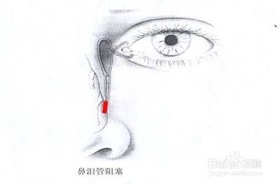 经常流眼泪是怎么回事