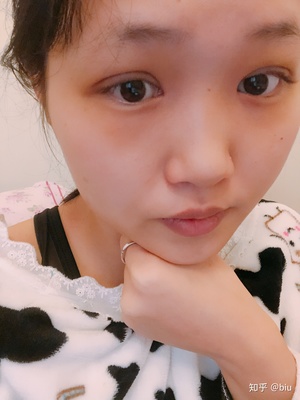 双眼皮结疤