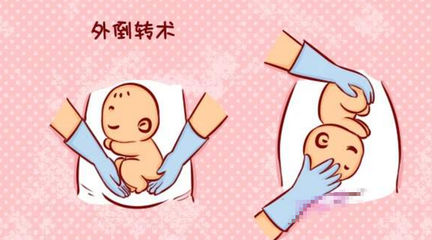 宝宝在肚子里的姿势