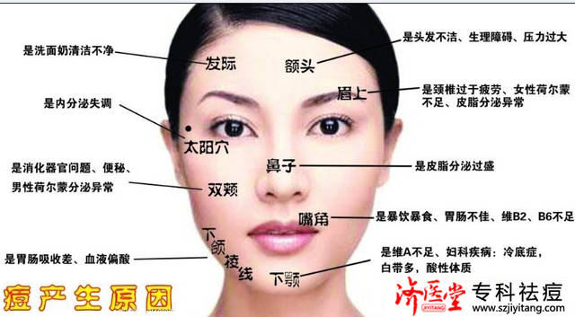眉上张痘痘是怎么回事