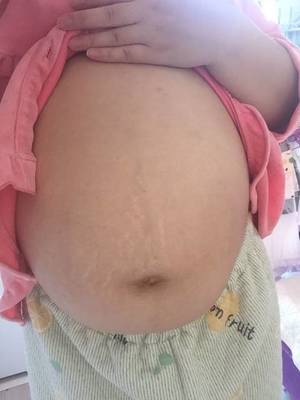 梦见自己生孩子出血