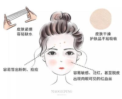 敏感痘痘肌护肤品