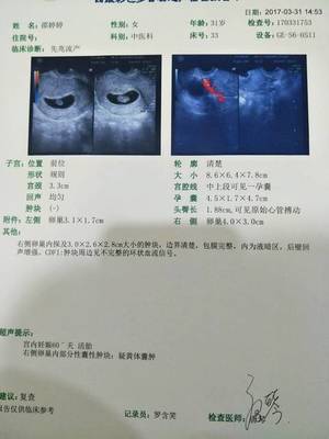 怀孕会分泌白带吗