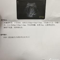 怀孕两个月能做吗