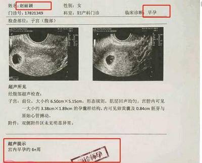 怀孕一个月胎儿有多大