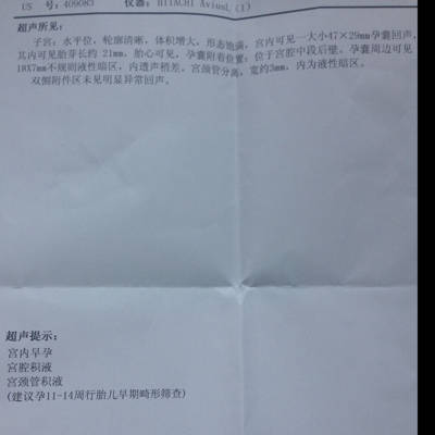宫颈管积液影响怀孕吗