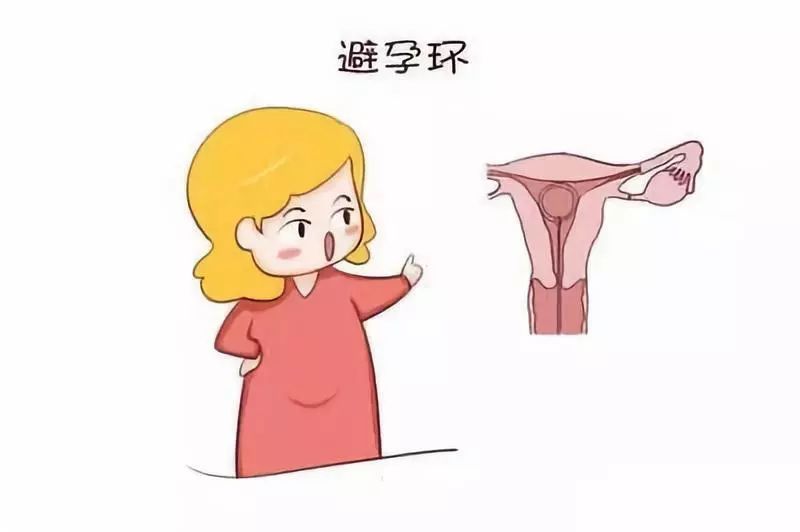 取环后是不是很难怀孕