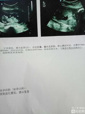 怀孕位置低