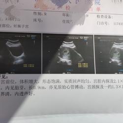 怀孕16周产检需要多少钱